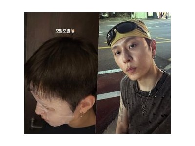 용준형 모발 걱정에 유쾌한 해명 날렸다
